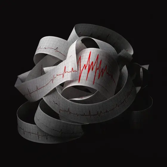 Тест на панические атаки — бесплатный онлайн тест